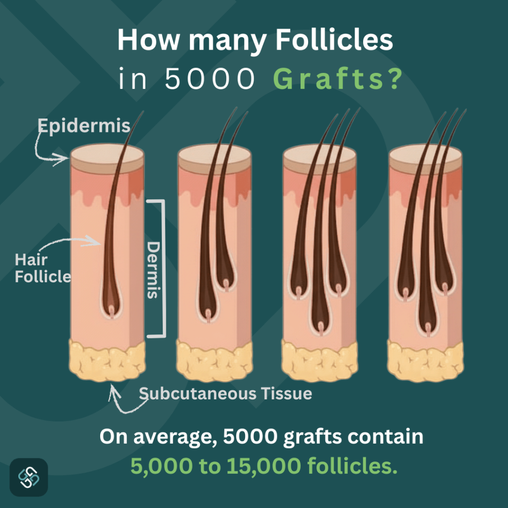 how many follicles in 5000 grafts