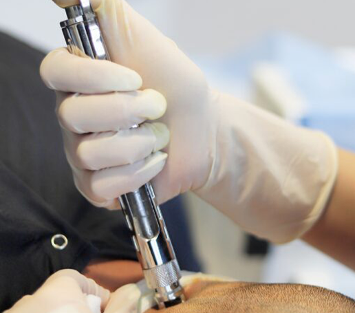 Pain-Free Anesthesia