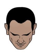 Minimal hair loss (Norwood 2)